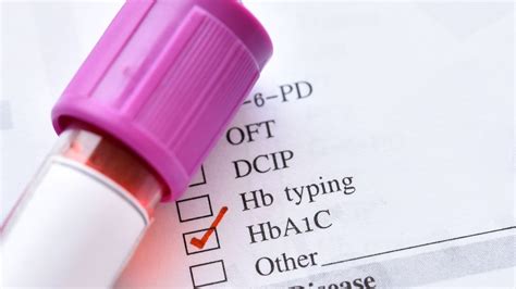 hbc1a|Hemoglobin A1C (HbA1c) Test: MedlinePlus Medical Test.